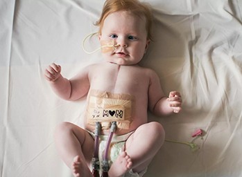 Baby with life saving medical device