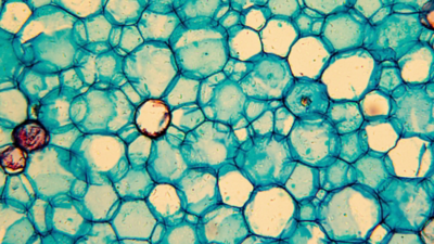 Cells being observed under microscope